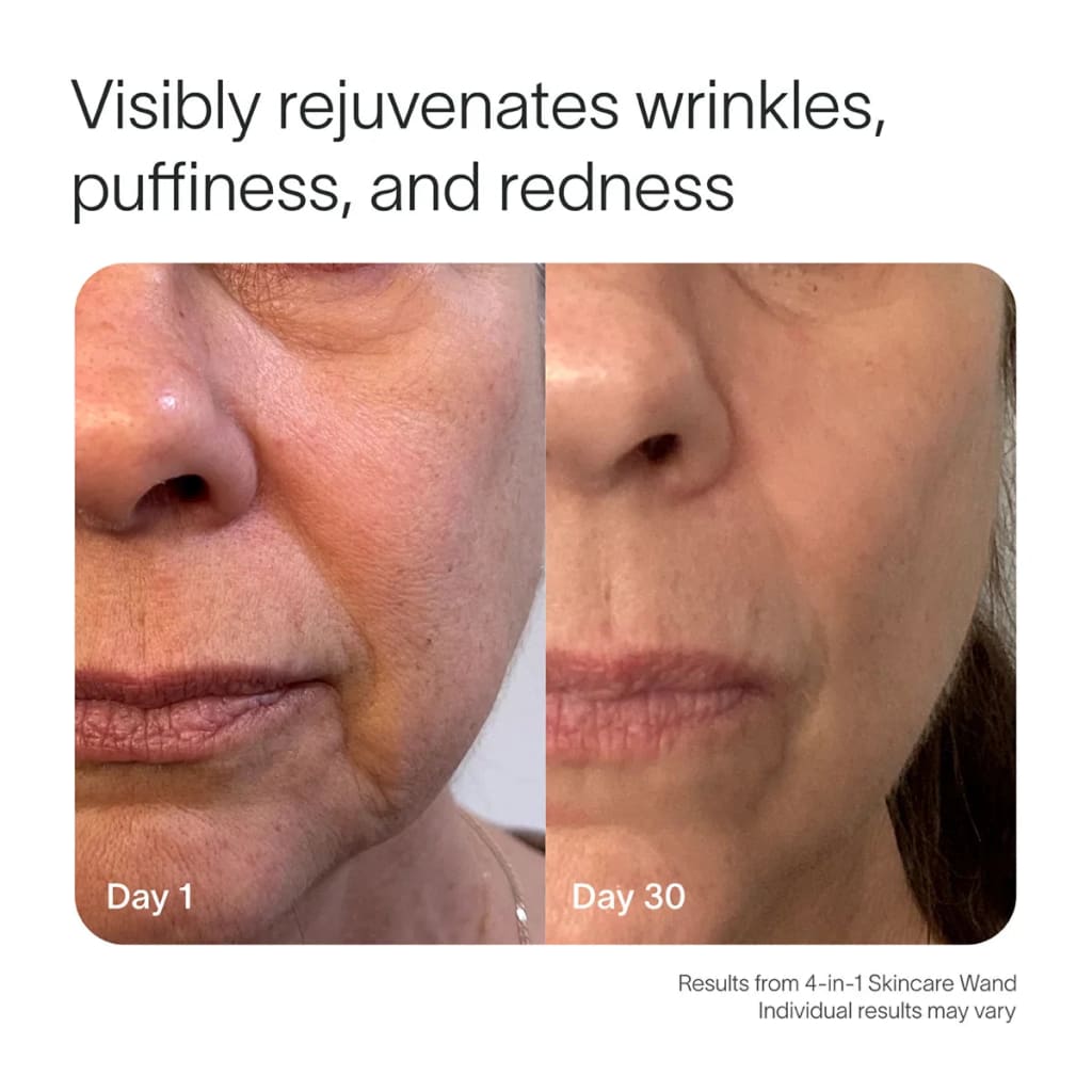 Ultimate 4-in-1 Skincare Wand Kit