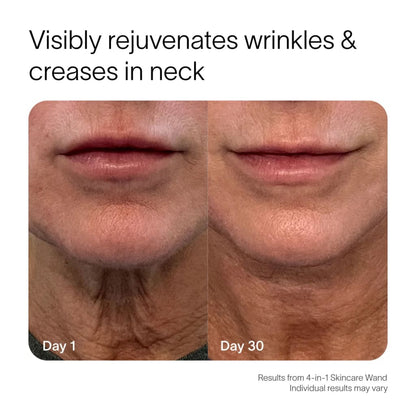 Ultimate 4-in-1 Skincare Wand Kit