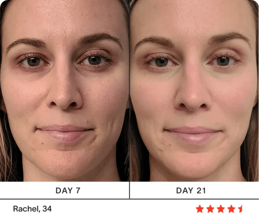 Ultimate 4-in-1 Skincare Wand Kit